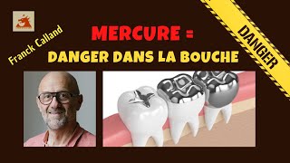 MERCURE  amalgames dentaires avec Franck Calland [upl. by Akirderf516]