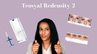 Teosyal Redensity 2 Under Eye Filler  Tear Trough Filler Explained [upl. by Airda]