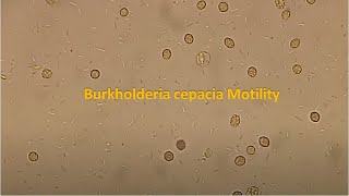 Burkholderia cepacia Motility [upl. by Leahcimsemaj712]