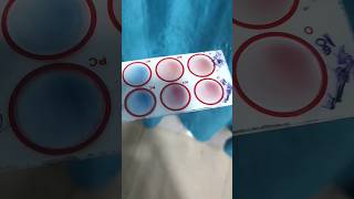 Agglutination test mixing procedure [upl. by Trellas475]