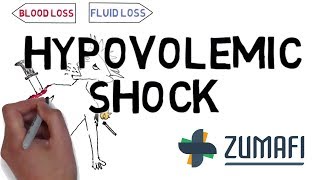 Hypovolemic shock  Introduction amp Causes [upl. by Neirda990]