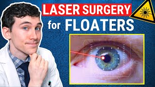 Laser Surgery for Eye Floaters Treatment Laser Vitreolysis [upl. by Sorrows]