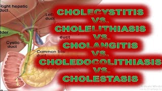 Perbedaan Cholelithiasis Cholecystitis Choledocolithiasis Cholangitis Definisi Patofisiologi Gejala [upl. by Gabey37]