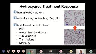 Pharmacokinetic Guided Dosing of Hydroxyurea [upl. by Coriss835]