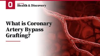 What is Coronary Artery Bypass Grafting CABG  Ohio State Medical Center [upl. by Yasmine]