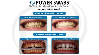 Power Swabs Teeth Whitening  March 2021 [upl. by Donata329]