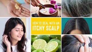 Itchy Scalp Treatments  Remedies For Dandruff Lice and Scalp Acne [upl. by Ninehc]