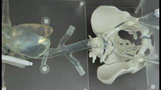 Transseptal model on pelvis sled [upl. by Noni82]