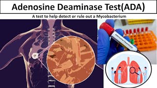 Adenosine Deaminase Test  Clear overview Tuberculosis ADAtestADAmlsmedilabacademy [upl. by Norri]