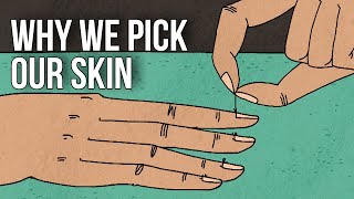 Artist who gives pictures away as therapy for compulsive skin picking disorder  BBC Stories [upl. by Lipinski323]