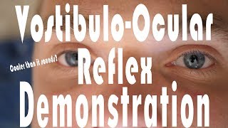 Caloric Testing COWS VestibuloOcular Reflex Hack  It Works [upl. by Morse]