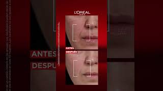 Resultados clínicos con Revitalift Laser de LOréal Paris [upl. by Perkins]