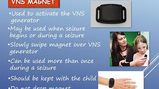 Vagus nerve stimulator  URIS [upl. by Ymmaj155]