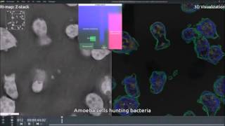 Hunting amoeba imaged in 3D realtime and markerfree as never before [upl. by Eneluqcaj]