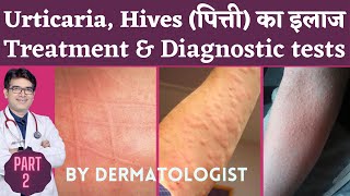 Skin Rash Urticaria Hives Treatment  Urticaria पित्ती उछलने ka ilaj  Dafad On Skin Treatment [upl. by Nilyad889]