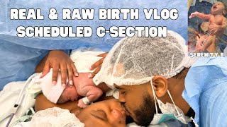 OUR REAL AND FULL BIRTH STORY SCHEDULED CSECTION [upl. by Snilloc]