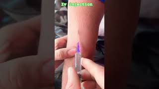 Iv injection vrailreels shortvideo shortvideo shorts [upl. by Akienom]