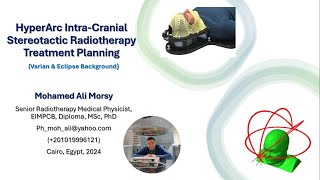 HyperArc Intra Cranial Stereotactic Radiotherapy Treatment Planning [upl. by Teodor]