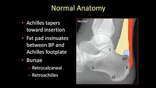 Emory MSK ELecture Series  Dr Hilary Umans [upl. by Samot454]