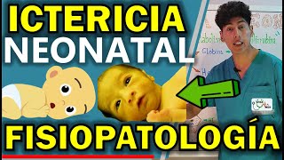 ICTERICIA NEONATAL FISIOPATOLOGÍA  GuiaMed [upl. by Lorien]