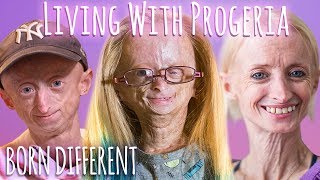 Living With Progeria 30 Min Documentary  BORN DIFFERENT [upl. by Noroj]