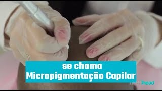 O que é Micropigmentação Capilar [upl. by Elbertina]