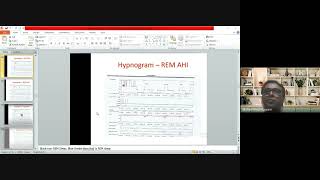 Interpreting Polysomnography [upl. by Araccat]