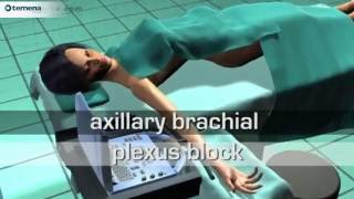 Axillary brachial plexus block [upl. by Walrath61]