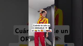 cuándo te sale un ORZUELO viral Tutorial como quitar un orzuelo humor eltaljg eltaljg colombia [upl. by Kannan]