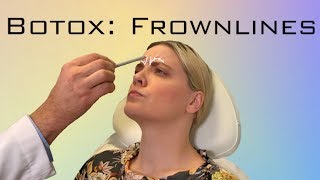 Botox How to Get Rid of Frown Lines [upl. by Alick]