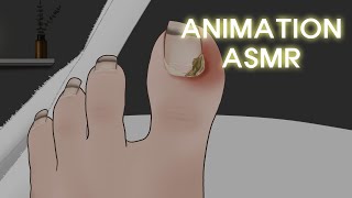 고막에 때려박는 팅글 사운드 리얼한 내성 발톱 치료 애니메이션 ASMR  Ingrown Toenail Removal treatment [upl. by Hnoj]