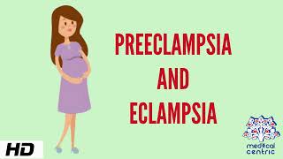 What is Preeclampsia Preeclampsia Animated Eclampsia [upl. by Dralliw]