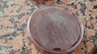 Bacillus subtilis on the blood agar [upl. by Eirtemed]