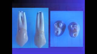 Important Anatomical Considerations for Endodontics [upl. by Vania]