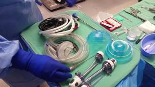 BASIC SET UP LAP CHOLECYSTECTOMY [upl. by Enwahs133]