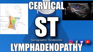 Sonoquickies  Cervical Lymphadenopathy [upl. by Retse542]