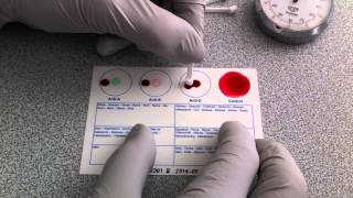 Blood Typing Using EldonCard HD [upl. by Astra]