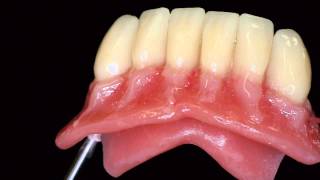 PALA creactive individualize the denture Heraeus english [upl. by Bortz]