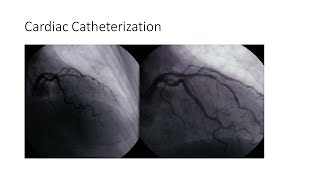 Cardiac Catheterization [upl. by Eldoria214]