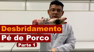 Desbridamento em pé de porco  Parte 1 [upl. by Edson790]