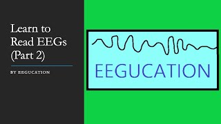 Getting a Good EEG Impedance  Webinar Series  Thought Technology Ltd [upl. by Dawes435]