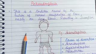 Achondroplasia Generalised bone disorders [upl. by Modesty]