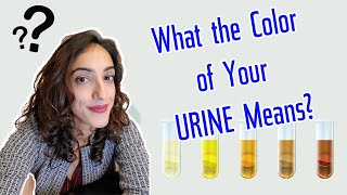 What does the COLOR of your URINE mean  A Urologist Explains [upl. by Ula7]