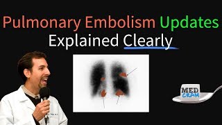 Pulmonary Embolism  Thromboembolism Updates Explained Clearly [upl. by Ayar]