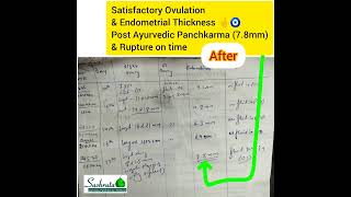 THIN ENDOMETRIUM TREATED WELL BY AYURVEDA AND PANCHKARMA [upl. by Ann]