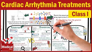 Pharmacology CVS 14 Cardiac Arrhythmia Treatments Class 1 Quinidine Procainamide Flecainide [upl. by Esiocnarf]