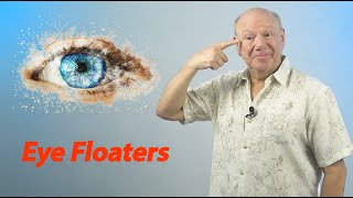 Eye Floaters Miracle Point [upl. by Kemppe]