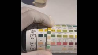 UTI dipstick test Urine Analysis [upl. by Eelsnia]