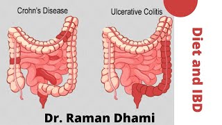 IBD irritable bowel disease  Diet Plan Ulcerative Colitis Crohns Disease [upl. by Pickar]