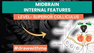 Midbrain Cross Sectional Anatomy  Internal features  level of Superior Colliculus [upl. by Richter]